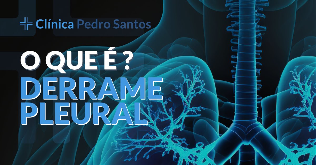 O que é um derrame pleural? O que é um derrame pleural?